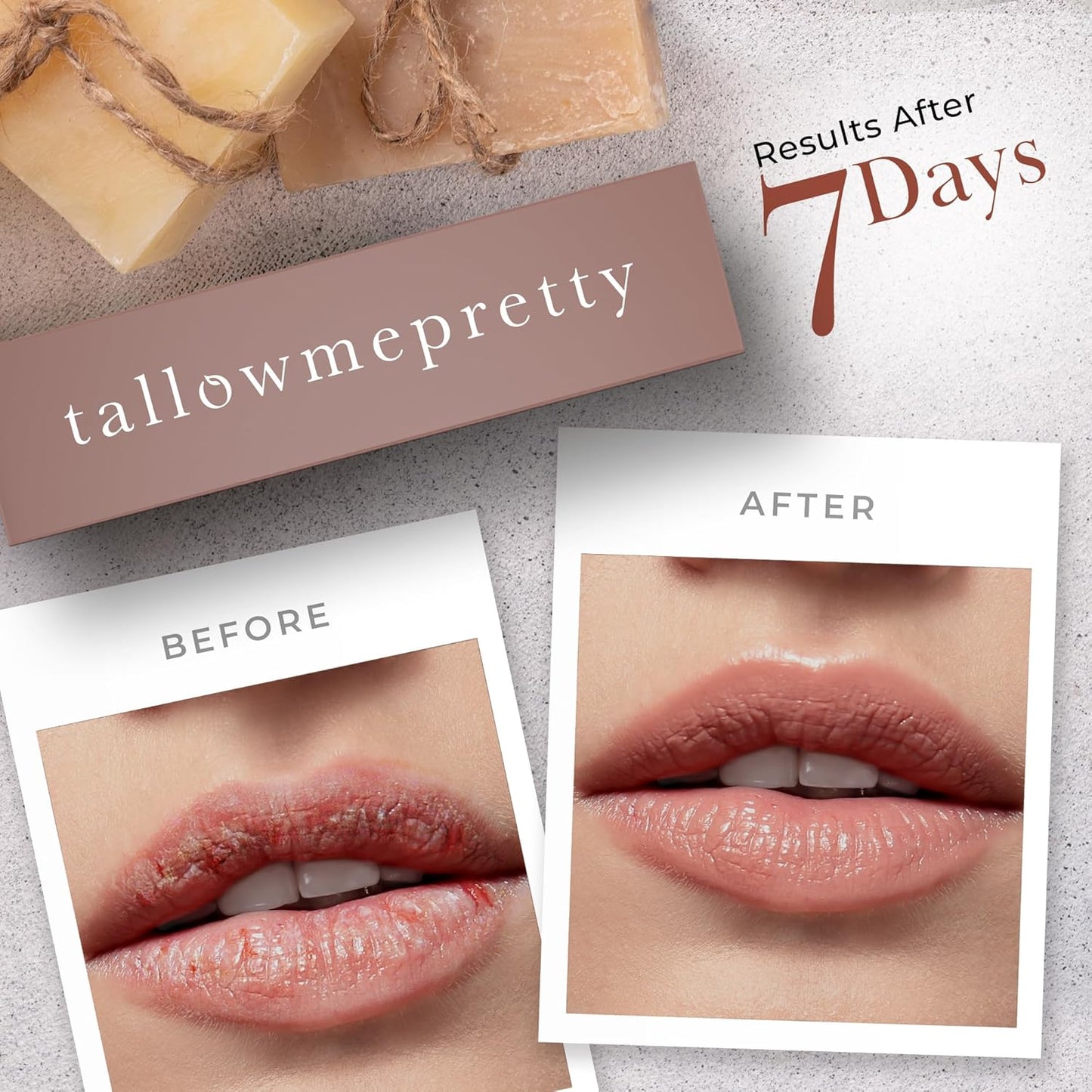 Unscented Lip Balm, Ultra-Soothing, Deeply Hydrating Tallow Lip Balm with Grass Fed Beef Tallow, Beeswax, Jojoba Oil & More, Non Toxic Lip Care, Made in the USA, 0.15 Oz.