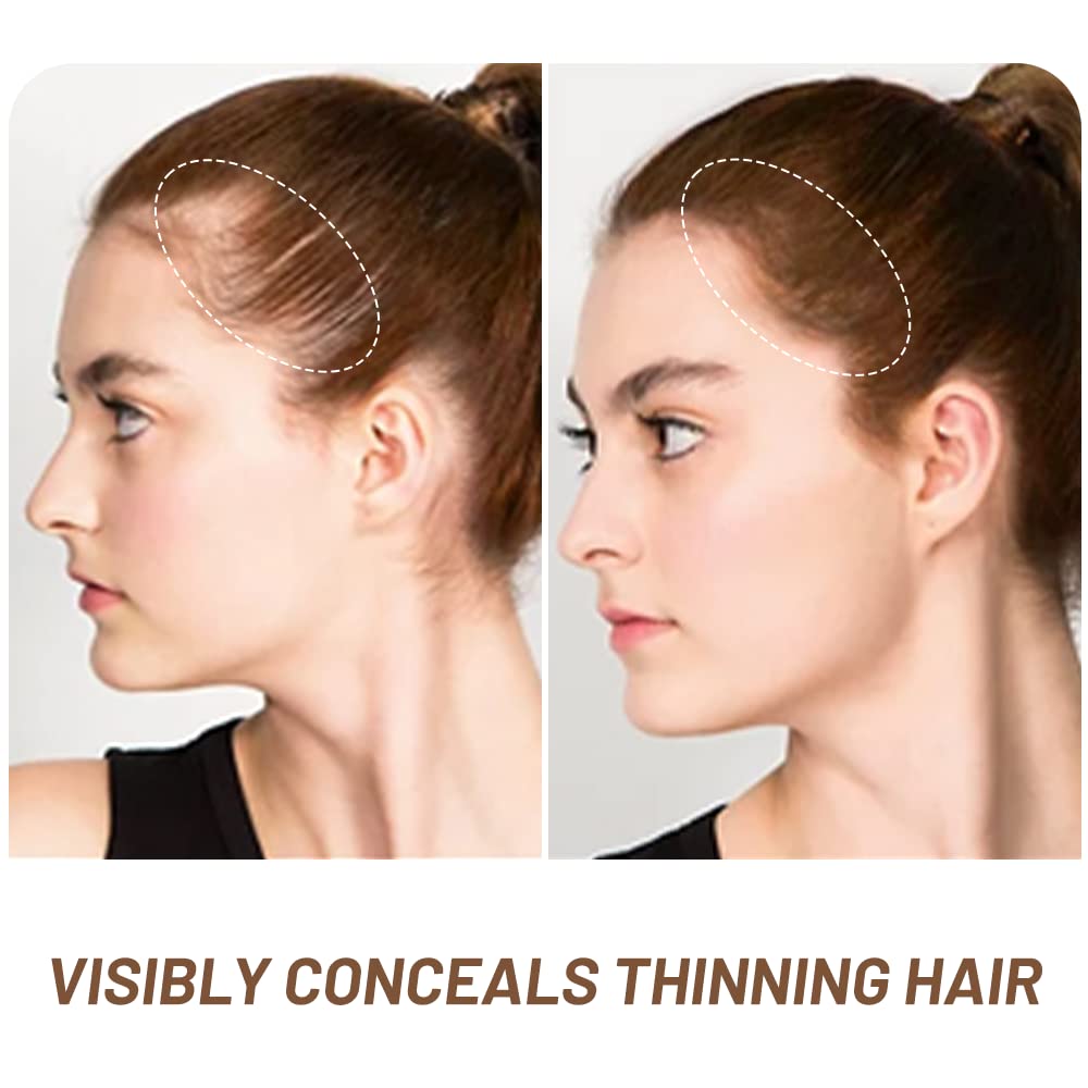 Root Touch Up Powder, Instantly Gray Root Cover Up Hairline Powder, Hair Concealer for Women and Men (A-Light Brown, 2PC)