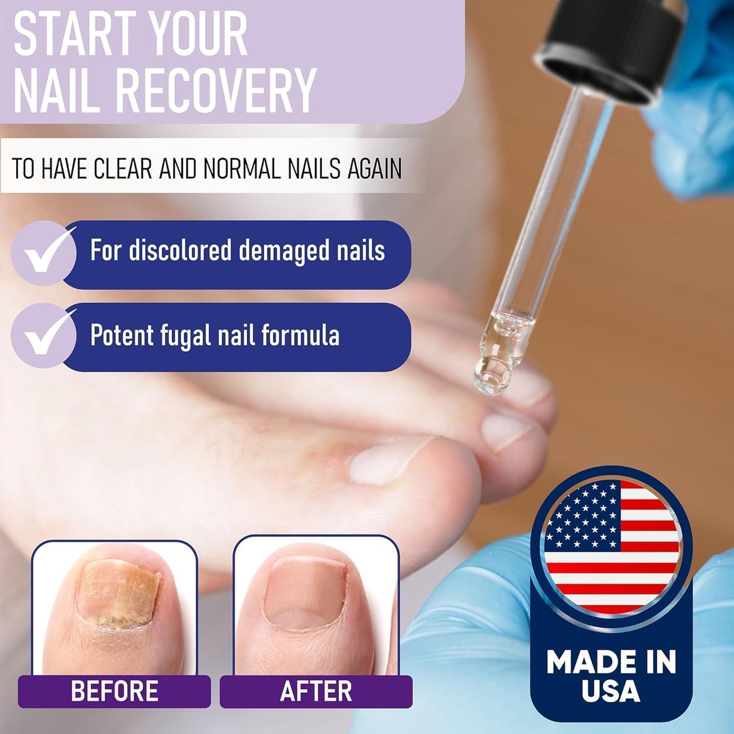 ZanaQuick Extra Strength Toenail & Fingernail Repair Drops - Nail Care Renewal for Thick, Damaged & Discolored Nails - 1 Pack, 0.50 fl oz