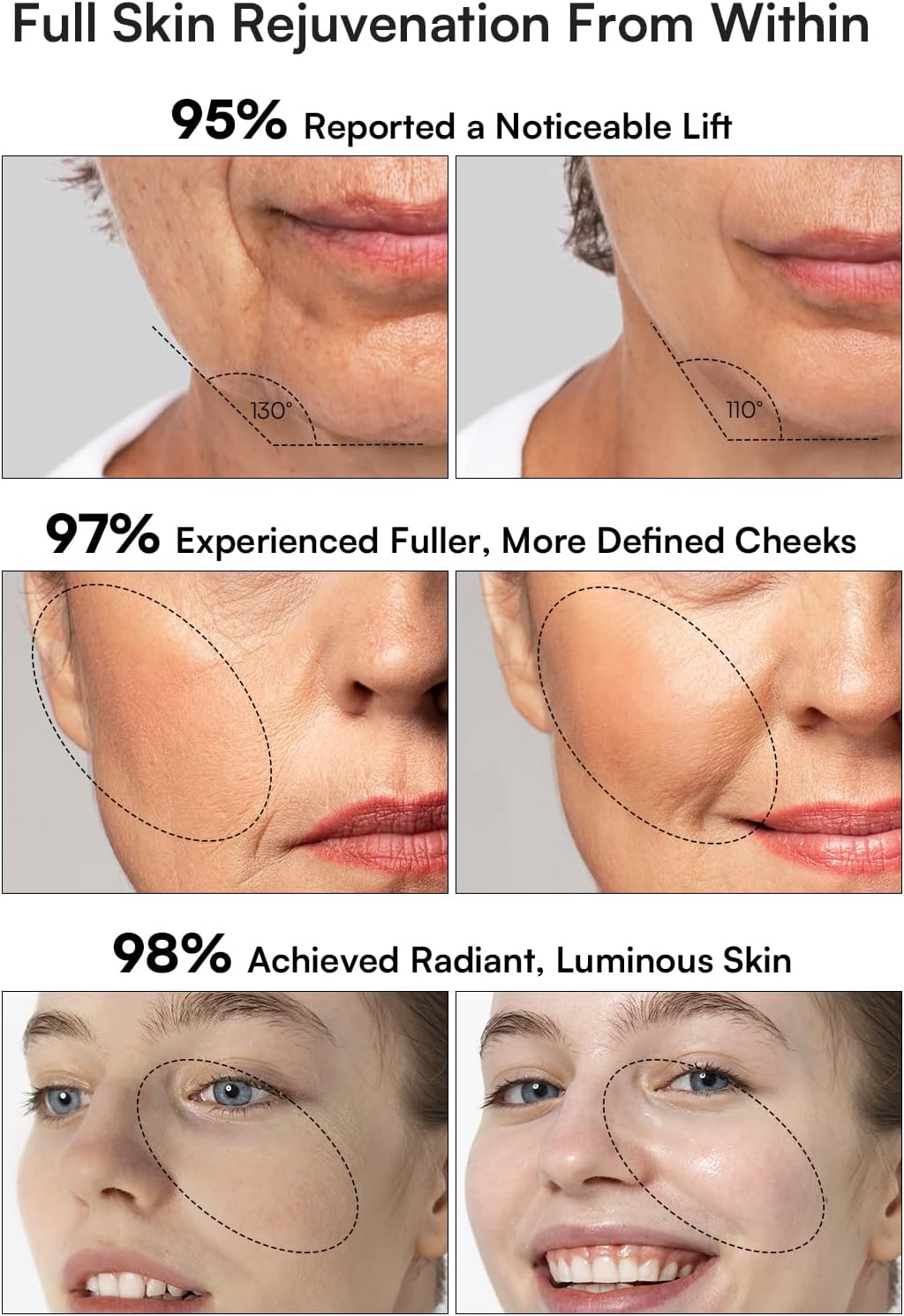 INIA 3-in-1 Red Light Therapy for Face and Neck Beauty Device for Puffiness & Skin Firming Skincare Tool