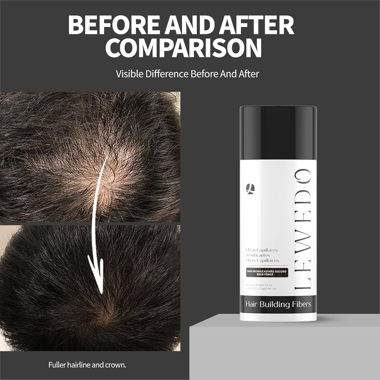 Hair Building Fibers 25G with Precision Spray Applicator - Electrostatic Adsorption for Instant Thicker Hair, Waterproof & Natural Look, Suitable for Men & Women (Dark brown)
