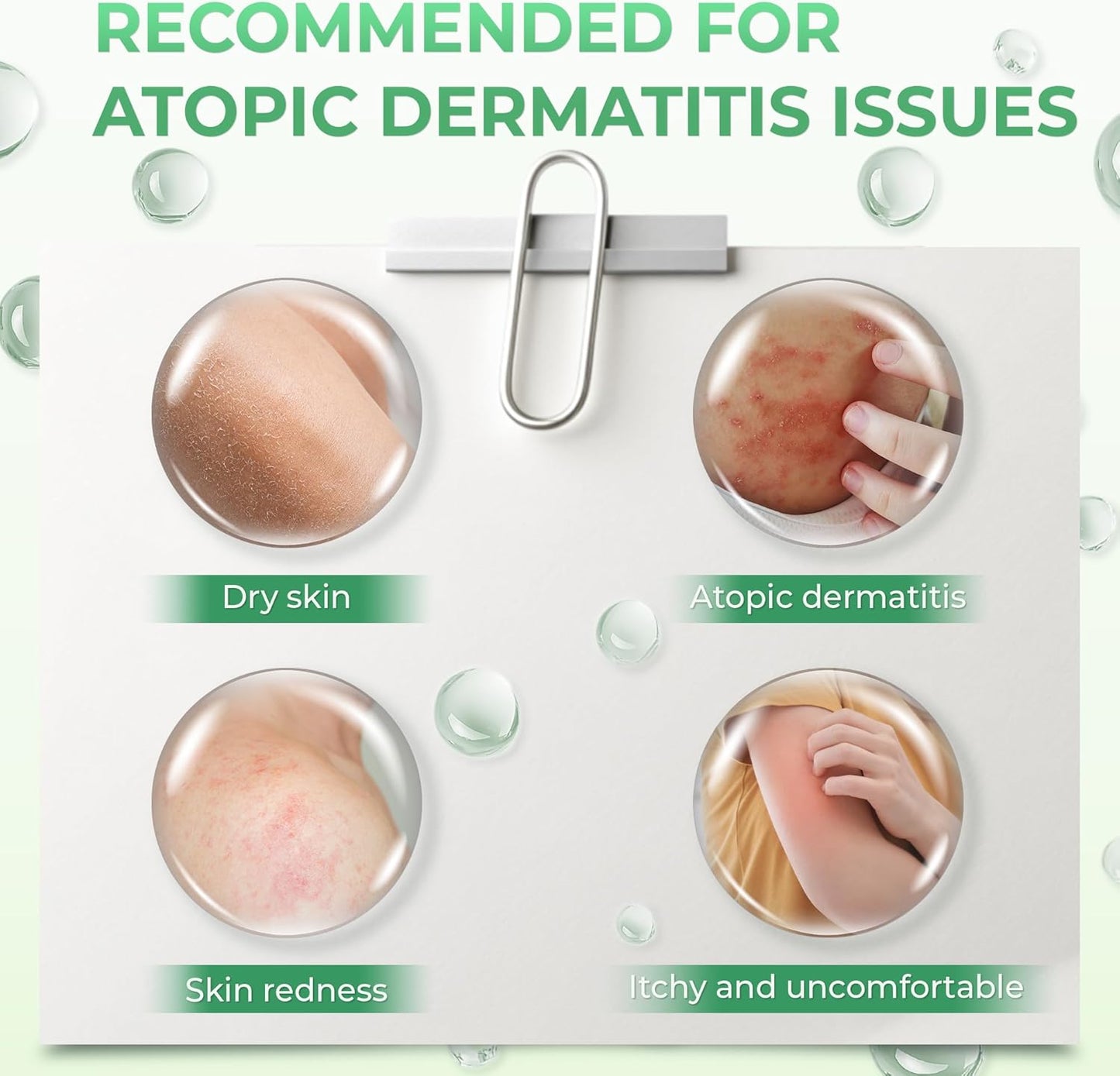 Atoskin Shower Gel (2 Pack) - for Eczema, Psoriasis, Dermatitis, and Anti-Itch Relief - Maximum Strength for Both Kids and Adults (13.6 oz)