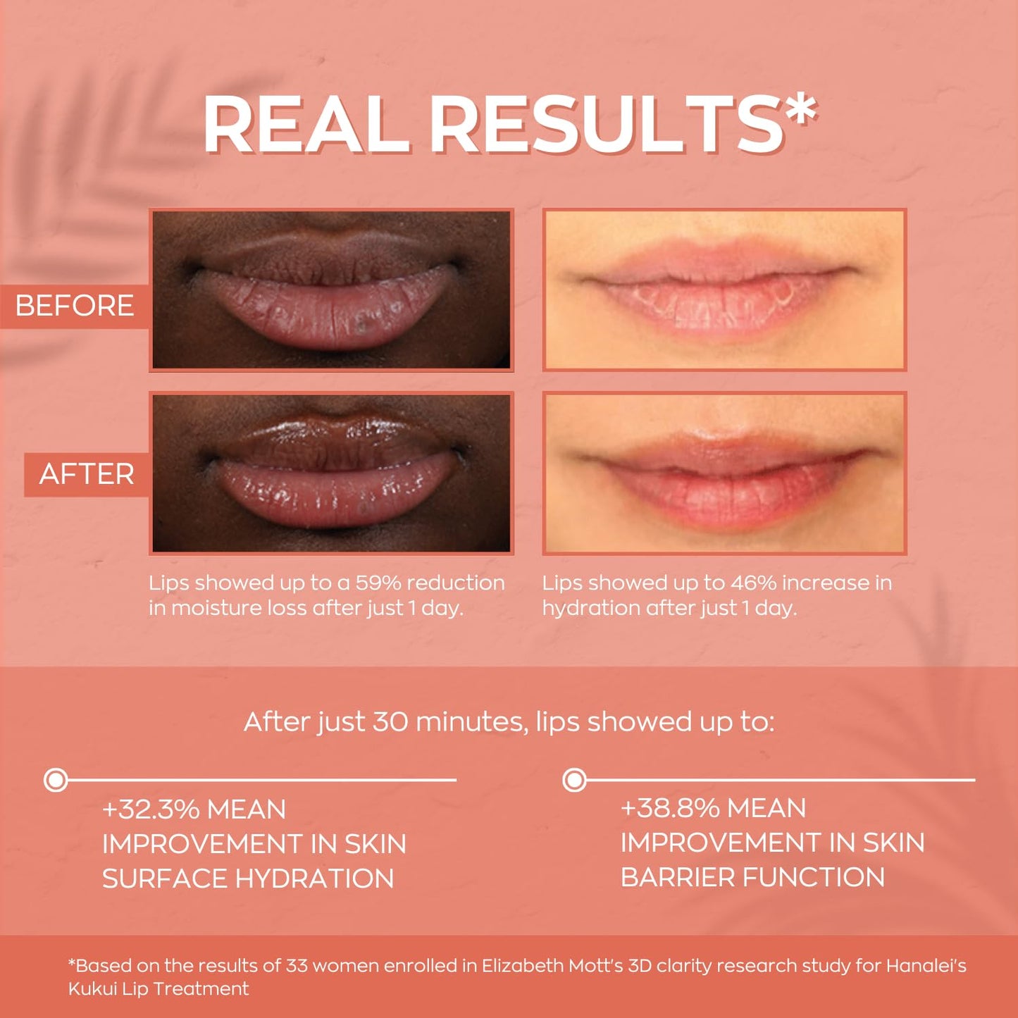 Hanalei Hydrating Lip Treatment Balm – Cruelty-Free, Paraben-Free Moisturizer for Severely Dry, Chapped Lips – Kukui Oil, Shea Butter & Grapeseed Oil –Multi Colored Tint, Travel-Size 3-Pack (5ml X 3)