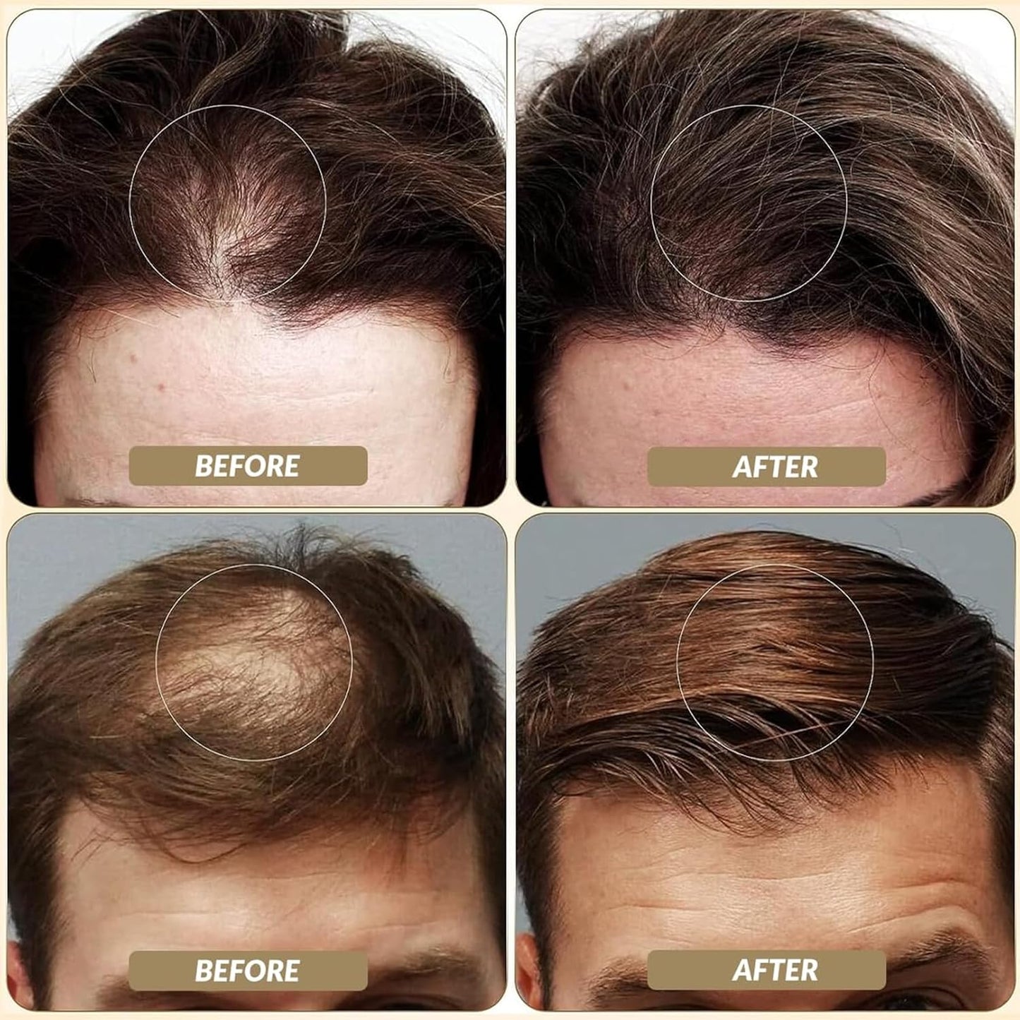 SOVONCARE Hair Fibers for Thinning Hair Medium Blonde, Hair Building Fibers for Bald Spots Undetectable & Natural Conceals Hair Loss Fill In Fine Hair Powder Hair Thicker Instantly for Women & Men 28g